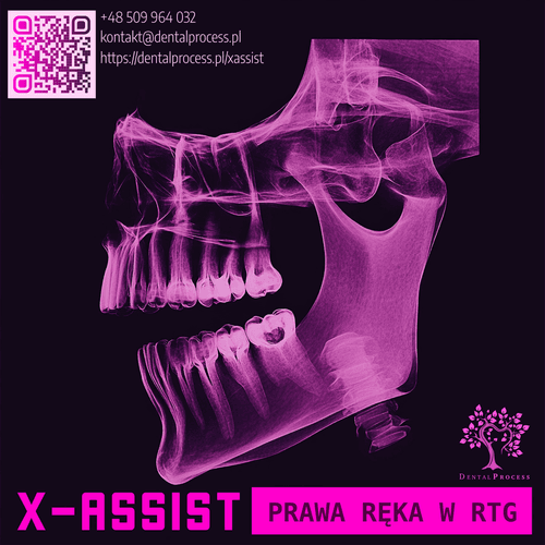 X-Assist
